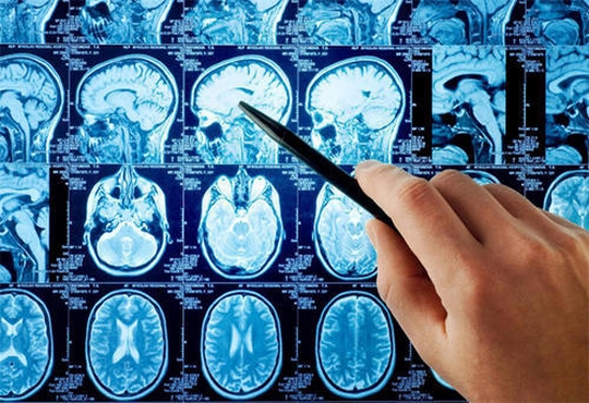 الأمراض الأكثر شيوعا في جراحة المخ والأعصاب
