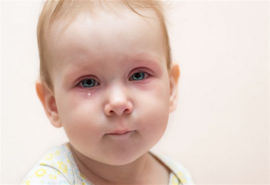 كل ما يجب معرفته حول علاج رمد العين للاطفال 