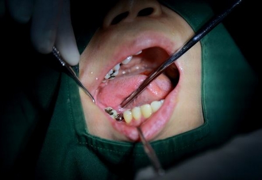 ما هي جراحة الأسنان؟ وأبرز ما يميّزها ؟