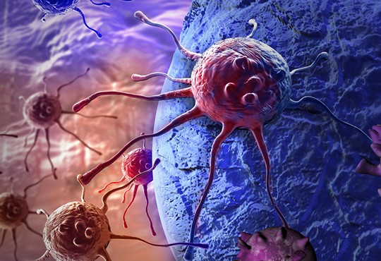 ماهي الآفات السرطانيّة التي يعالجها طب الأورام؟